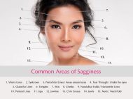 Lift Treatment - Younger Looking | Firm | HIFU | Thread Lift | Non-Surgical Facelift