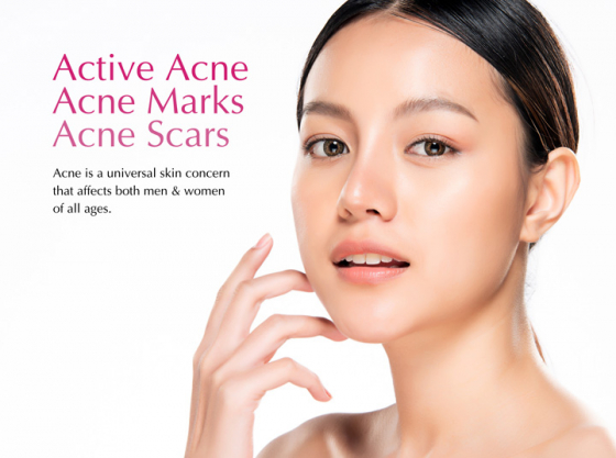 Dr.D Clinic Acne Treatment - Acne Free | Clear Skin | Smooth Skin | Scar Free
