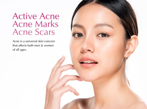 Dr.D Clinic Acne Treatment - Acne Free | Clear Skin | Smooth Skin | Scar Free