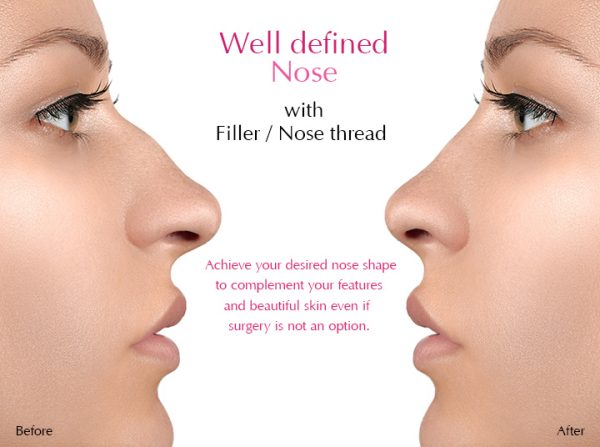 Dr.D Clinic - Nose Enhancement